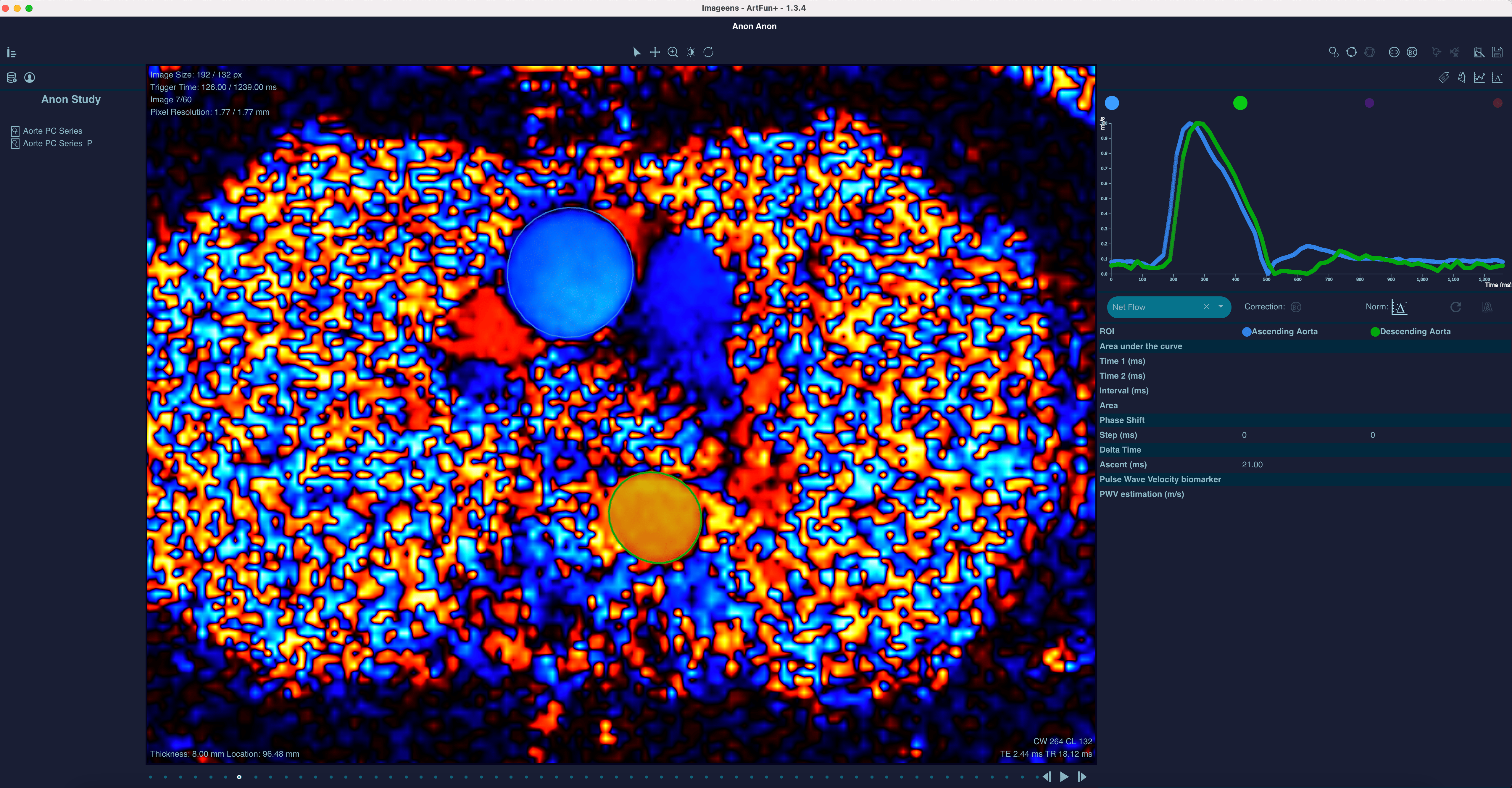 ArtFun+ imaging example